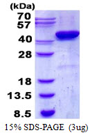 3 μg by SDS-PAGE under reducing condition and visualized by coomassie blue stain